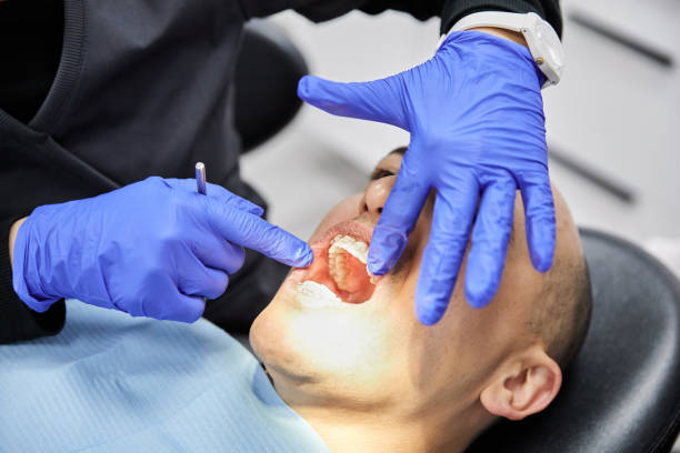 Best Emergency Treatment for Oral Infections in Hillsborough, NJ